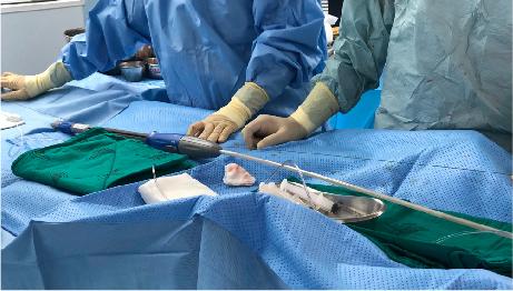 Catheter procedure in the vascular suite during EKOS treatment for pulmonary embolism