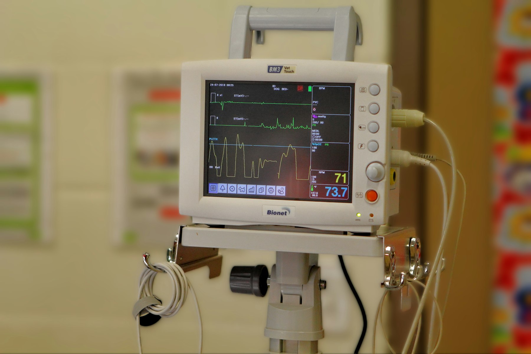 Bedside heart monitor tracking rhythm, pulse and oxygen during recovery