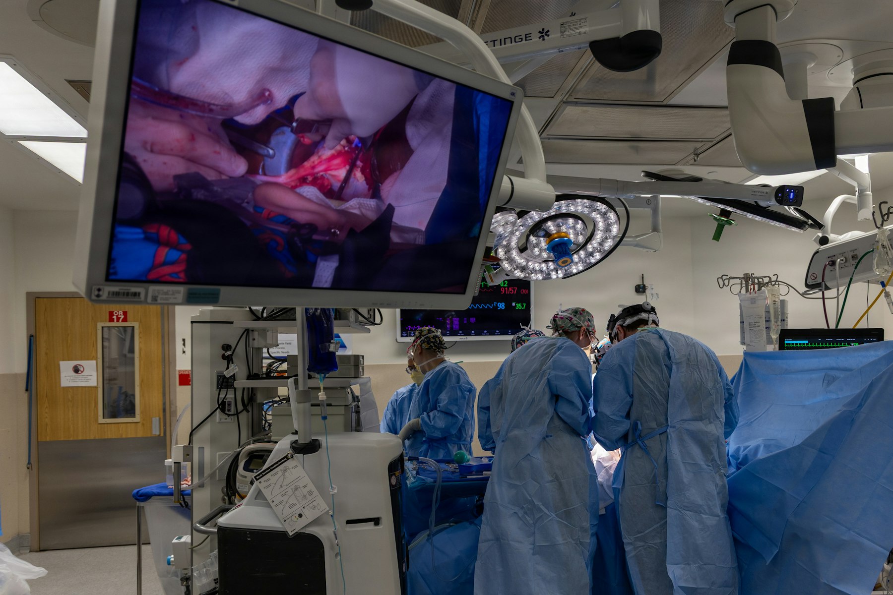 Cardiac care team performing a catheter-based procedure while watching live images on a large screen