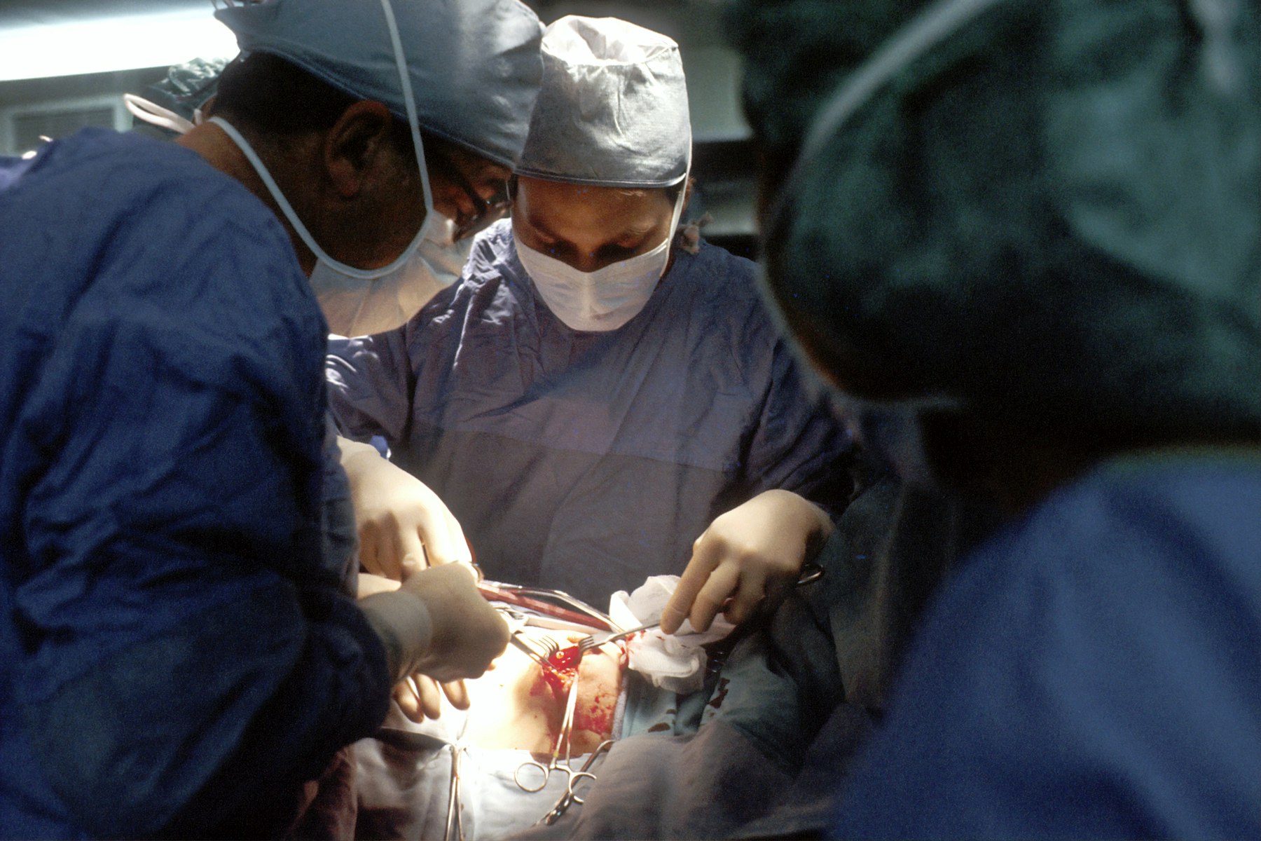 Cardiac surgeons performing open heart surgery such as the Maze procedure