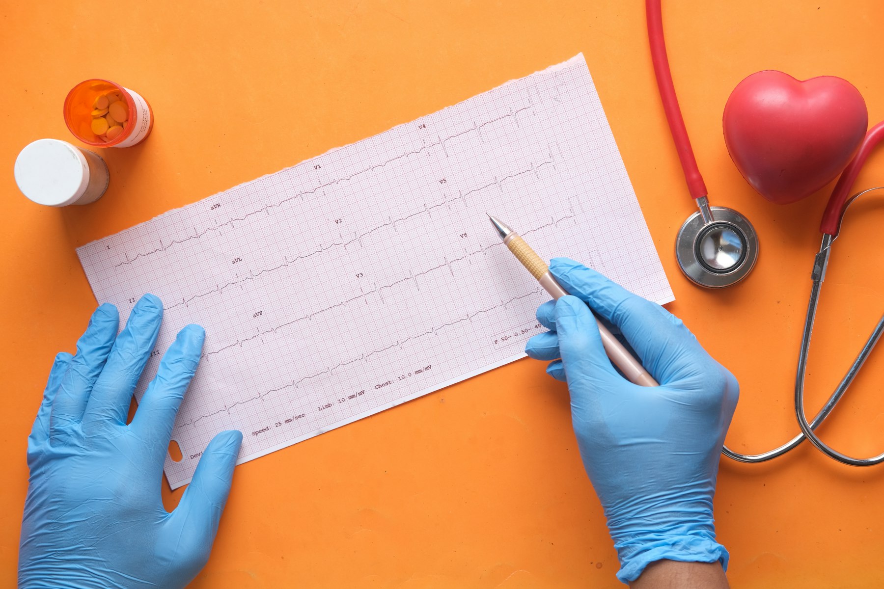 Doctor reviewing an ECG tracing for signs of atrial fibrillation