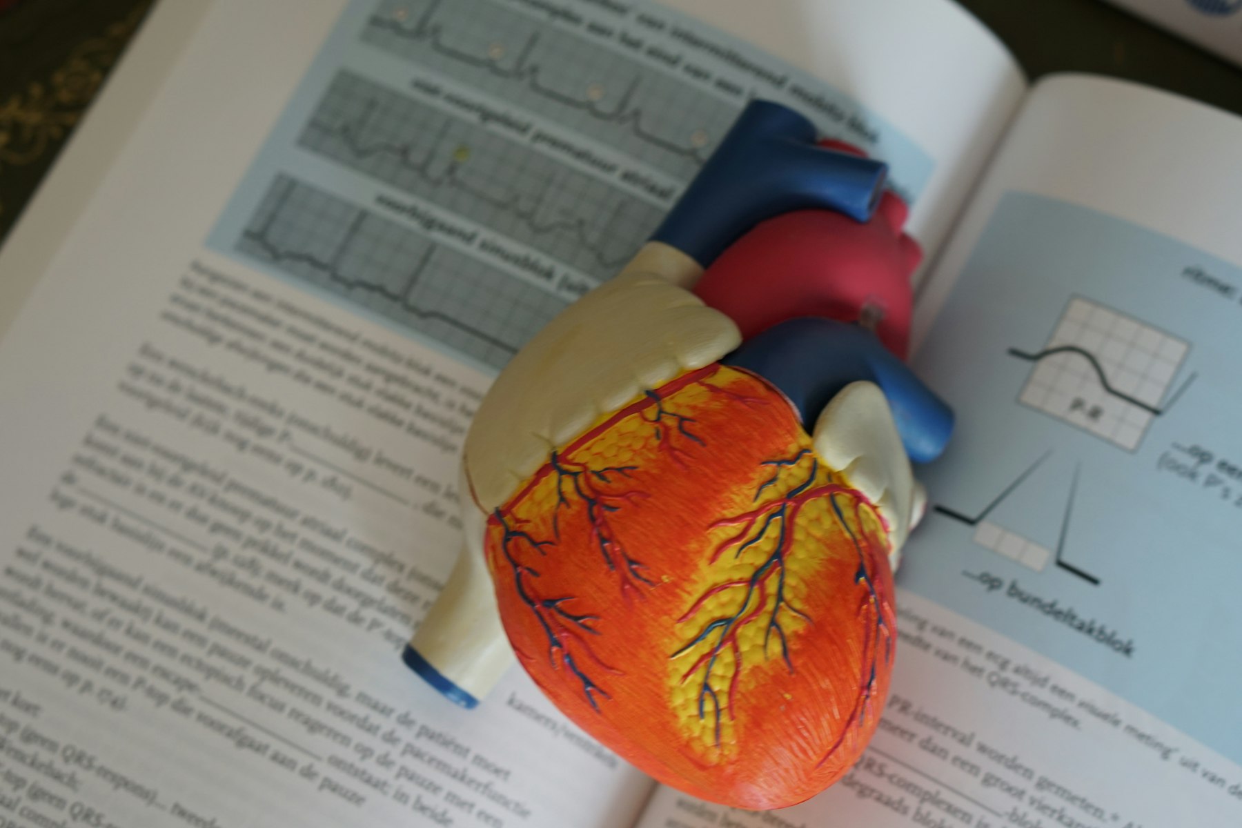 Anatomical heart model used to explain heart failure and ICD protection