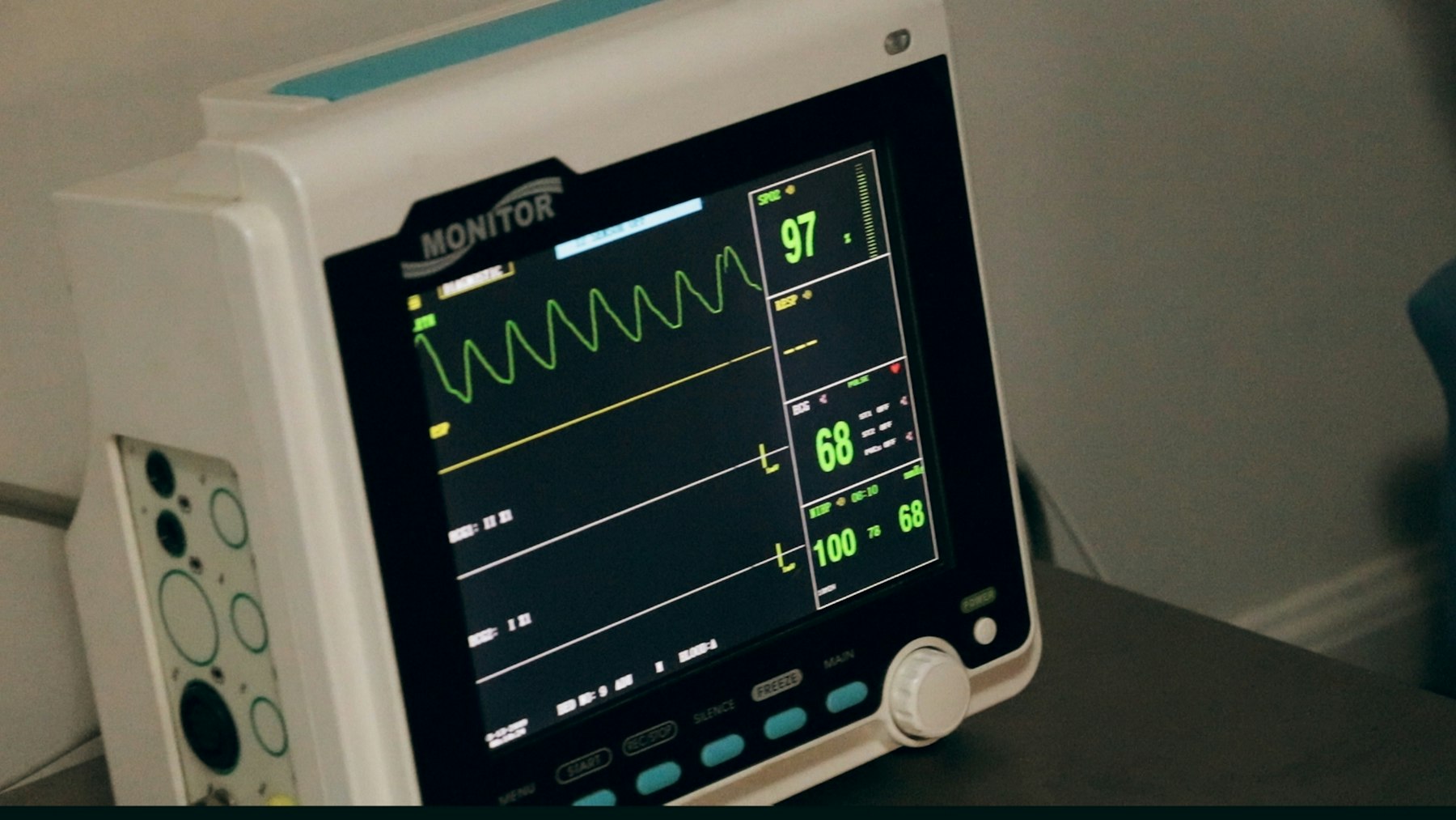 Heart rhythm monitor used to watch the heartbeat after surgery
